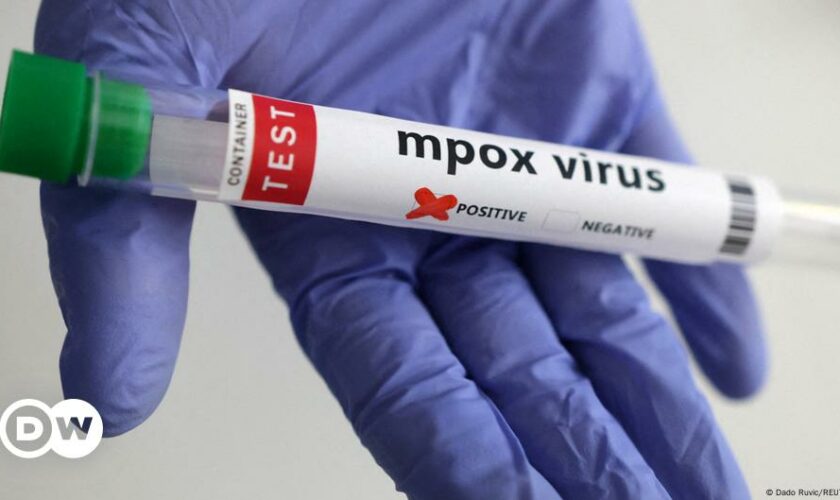 US reports first case of new mpox variant