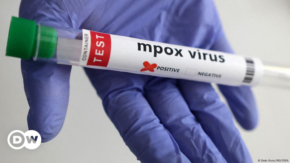 US reports first case of new mpox variant