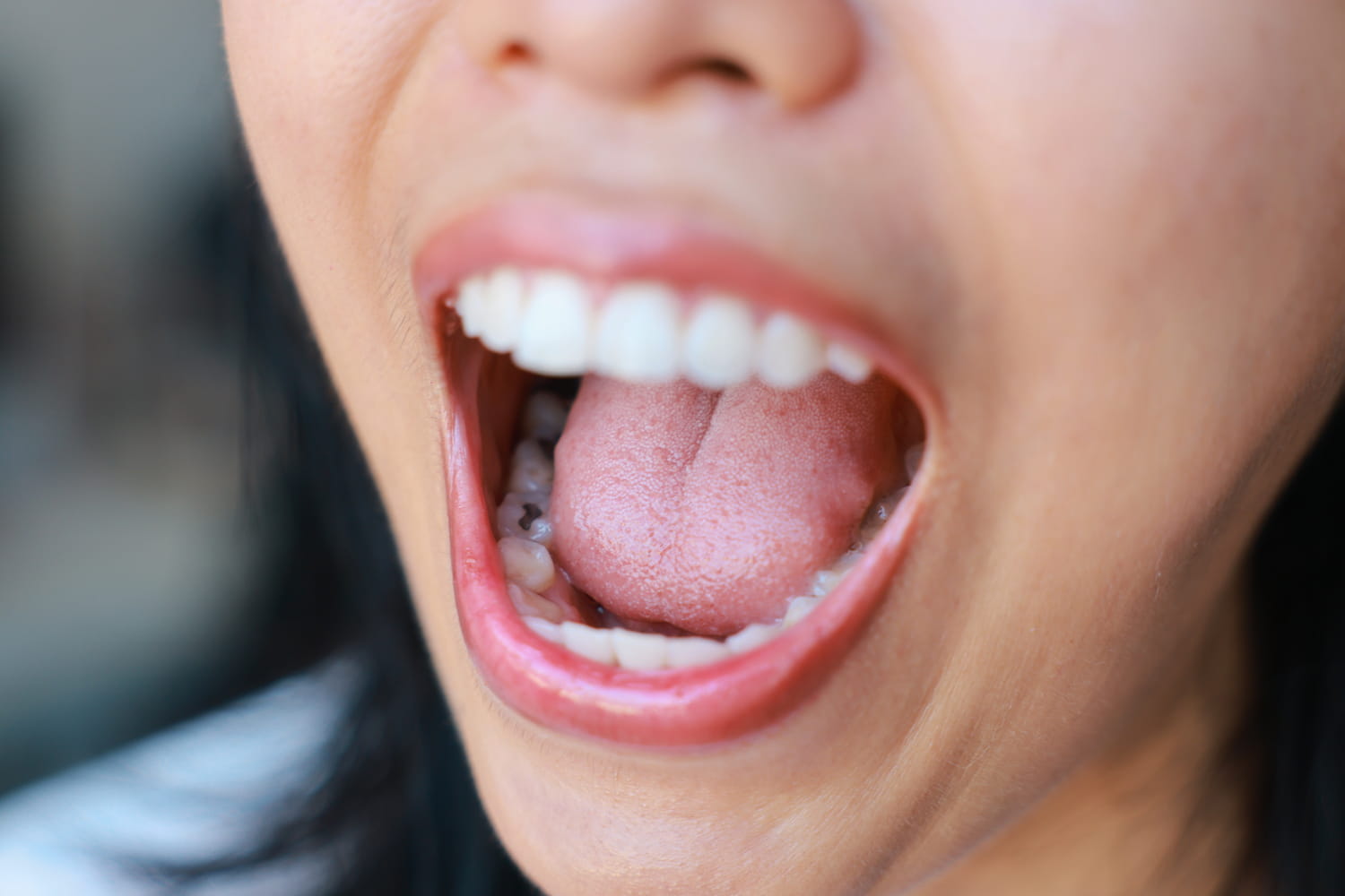 Ce produit que vous avez peut-être dans votre bouche sera interdit d'ici quelques jours, "une bonne chose" selon un dentiste