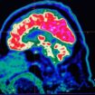 Scientists measure exact speed of human thought and the results are surprising