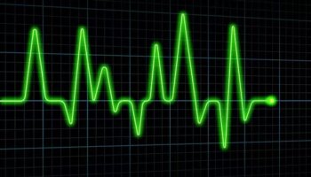 'Artificial Intelligence reading ECGs to predict heart attacks and patient deaths'