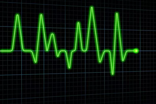 'Artificial Intelligence reading ECGs to predict heart attacks and patient deaths'