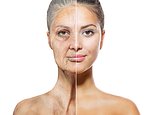 Dermatologists reveal how wrinkly your skin will be in years to come based on subtle warning signs - and what to do NOW to prevent it