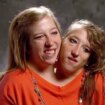 How can conjoined twins have a baby as world-famous Hensel sisters spark rumours