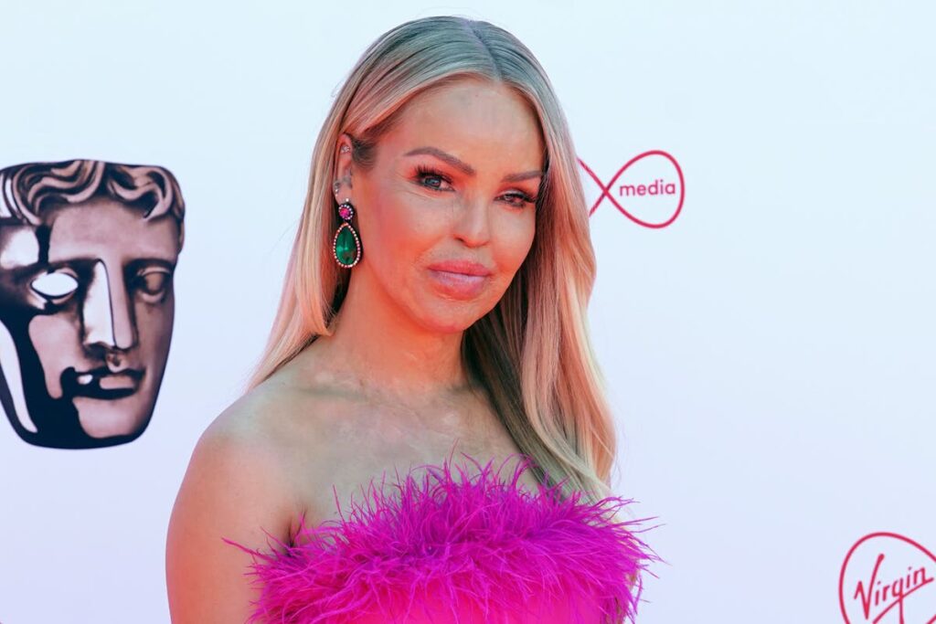 Katie Piper shares artificial eye decision 16 years after acid attack