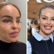 Katie Piper reveals decision to be fitted with ‘artificial eye’ 16 years after acid attack