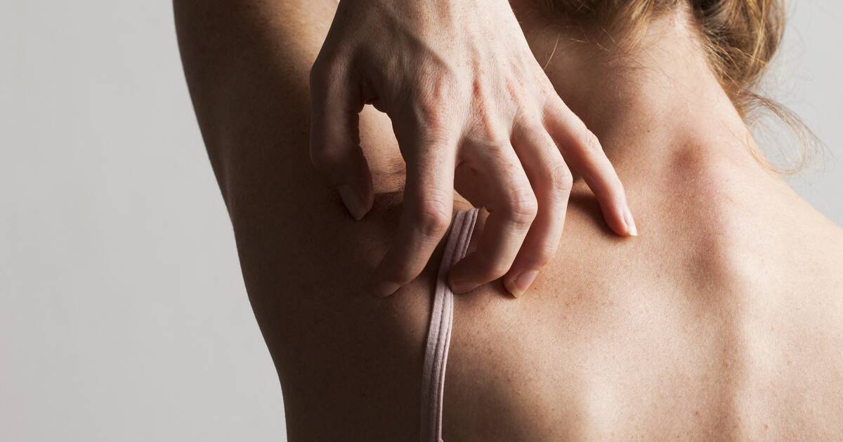 Eczéma : la science fait un pas en avant sur les liens entre démangeaisons et douleur