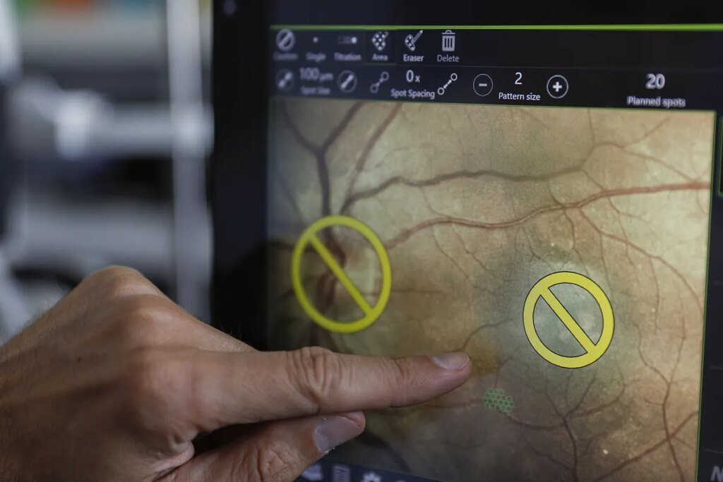 El poder predictivo de la retina ante fallos cerebrovasculares: "Ha abierto las posibilidades para la identificación de marcadores biológicos"