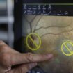 El poder predictivo de la retina ante fallos cerebrovasculares: "Ha abierto las posibilidades para la identificación de marcadores biológicos"