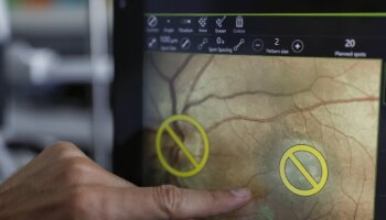 El poder predictivo de la retina ante fallos cerebrovasculares: "Ha abierto las posibilidades para la identificación de marcadores biológicos"