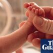 Microplastics in placentas linked to premature births, study suggests