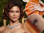 Zendaya sparks Tom Holland engagement rumors at 2025 Golden Globes with diamond ring and tiny tattoo