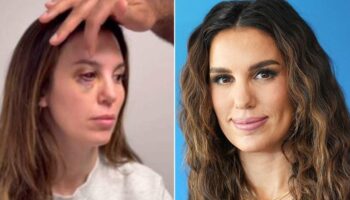 Christy Carlson Romano calls it a 'miracle' she isn't blind after bullet came within a millimeter of her eye