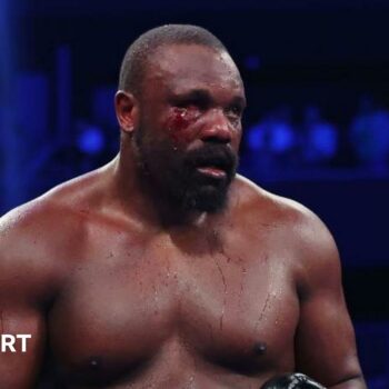 Derek Chisora with blood on his face