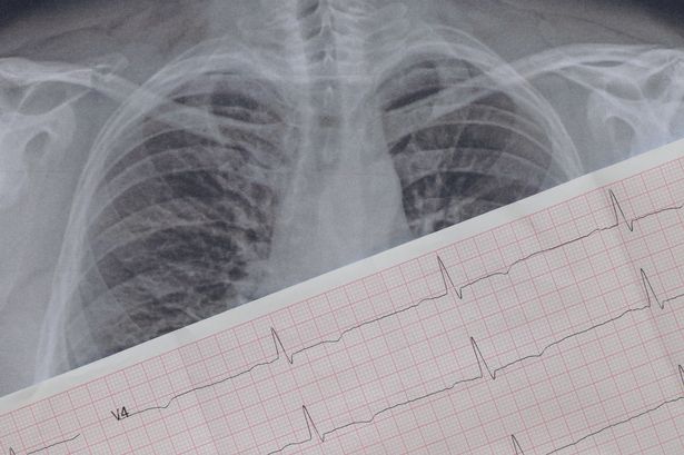 Cardiologist warns of 'very dangerous and harmful' mistake over heart palpitations