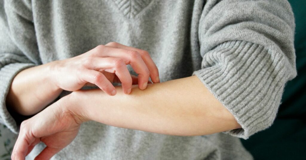 Does scratching an itchy rash really make it worse? Scientists have finally worked it out