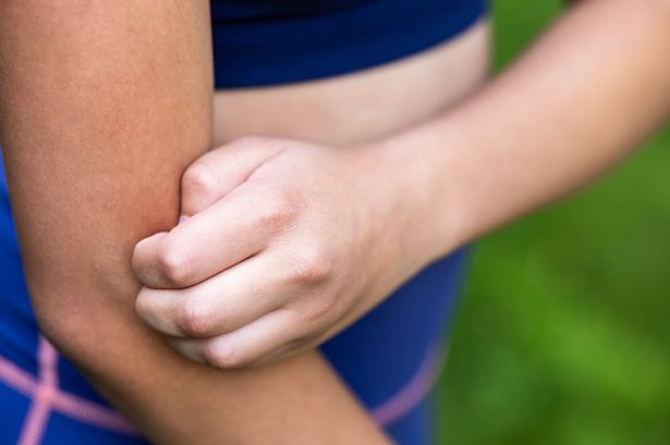 Little-known disease and animal bite signs and symptoms that show on skin