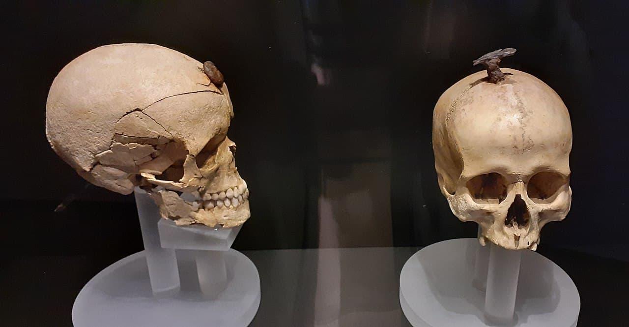 Intrigue Behind the Severed Skulls: Insights into Ancient Mortuary practices